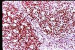 Ki-67 Antibody in Immunohistochemistry (Paraffin) (IHC (P))