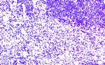 CCR7 Antibody in Immunohistochemistry (Paraffin) (IHC (P))