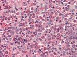 CXCR4 Antibody in Immunohistochemistry (IHC)