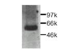 CTGF Antibody in Western Blot (WB)