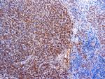 alpha-1 Antitrypsin Antibody in Immunohistochemistry (Paraffin) (IHC (P))