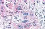 XPR1 Antibody in Immunohistochemistry (Paraffin) (IHC (P))