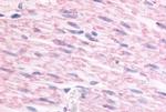 alpha-2c Adrenergic Receptor Antibody in Immunohistochemistry (Paraffin) (IHC (P))