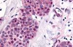 TLX Antibody in Immunohistochemistry (Paraffin) (IHC (P))