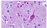 mGluR4 Antibody in Immunohistochemistry (Paraffin) (IHC (P))