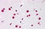 NR5A1 Antibody in Immunohistochemistry (Paraffin) (IHC (P))