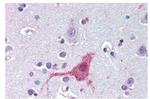 Endothelin B Receptor Antibody in Immunohistochemistry (Paraffin) (IHC (P))