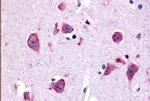 TAOK1 Antibody in Immunohistochemistry (Paraffin) (IHC (P))