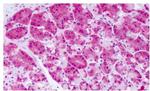 PRKD2 Antibody in Immunohistochemistry (Paraffin) (IHC (P))