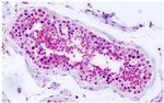 PRKD2 Antibody in Immunohistochemistry (Paraffin) (IHC (P))