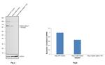 Catenin alpha-1 Antibody in Western Blot (WB)