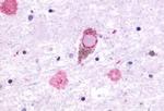 GPR27 Antibody in Immunohistochemistry (Paraffin) (IHC (P))