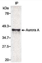 Aurora A Antibody in Immunoprecipitation (IP)