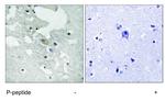 Phospho-BLNK (Tyr84) Antibody in Immunohistochemistry (Paraffin) (IHC (P))