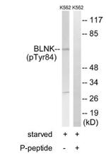 Phospho-BLNK (Tyr84) Antibody in Western Blot (WB)