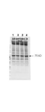 Phospho-NF2 (Ser518) Antibody in Western Blot (WB)