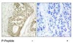 Phospho-PKC delta (Ser645) Antibody in Immunohistochemistry (Paraffin) (IHC (P))