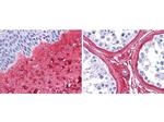 Collagen III Antibody in Immunohistochemistry (Paraffin) (IHC (P))