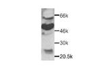 CX3CR1 Antibody in Western Blot (WB)