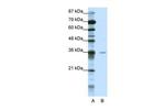 MBD2 Antibody in Western Blot (WB)