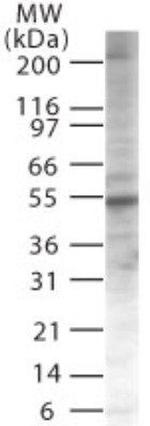 PIASy Antibody in Western Blot (WB)