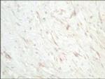 SFRP1 Antibody in Immunohistochemistry (IHC)