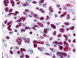 GLI3 Antibody in Immunohistochemistry (Paraffin) (IHC (P))