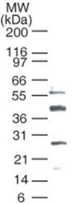 Bcl-3 Antibody in Western Blot (WB)