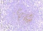 CCR8 Antibody in Immunohistochemistry (Paraffin) (IHC (P))