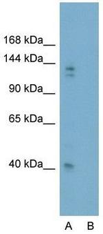 GLI2 Antibody in Western Blot (WB)