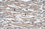 DLX2 Antibody in Immunohistochemistry (Paraffin) (IHC (P))