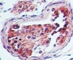 HTR3A Antibody in Immunohistochemistry (Paraffin) (IHC (P))