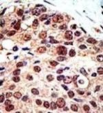 PRMT3 Antibody in Immunohistochemistry (Paraffin) (IHC (P))