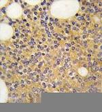 PRMT3 Antibody in Immunohistochemistry (Paraffin) (IHC (P))