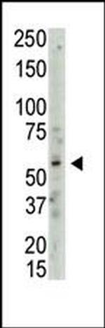 PRMT3 Antibody in Western Blot (WB)