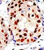 PRMT1 Antibody in Immunohistochemistry (Paraffin) (IHC (P))