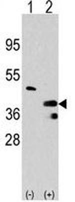 PRMT1 Antibody in Western Blot (WB)