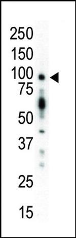 PKC mu Antibody in Western Blot (WB)