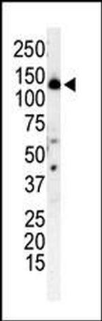 PIK3R4 Antibody in Western Blot (WB)