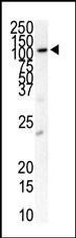 PDGFRB Antibody in Western Blot (WB)