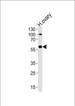 RYK Antibody in Western Blot (WB)