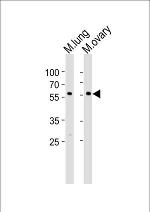 RYK Antibody in Western Blot (WB)