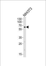 RYK Antibody in Western Blot (WB)