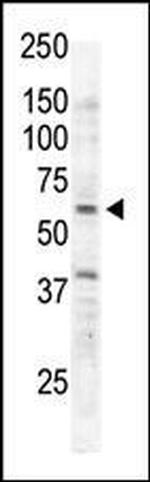 RYK Antibody in Western Blot (WB)