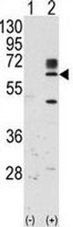 RYK Antibody in Western Blot (WB)