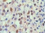 NFkB p65 Antibody in Immunohistochemistry (Paraffin) (IHC (P))