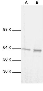 NFkB p65 Antibody in Western Blot (WB)