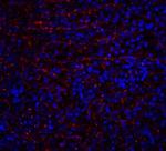 DR4 Antibody in Immunohistochemistry (Paraffin) (IHC (P))