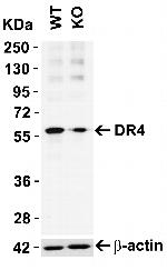 DR4 Antibody in Western Blot (WB)