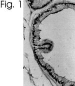 Estrogen Receptor alpha Antibody in Immunohistochemistry (IHC)